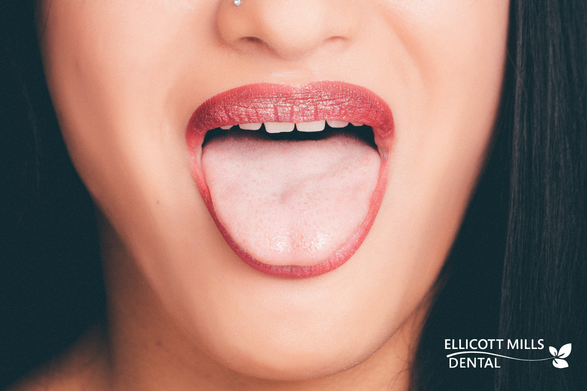 Your Tongue Speaks Volumes About Your Health - Ellicott Mills Dental
