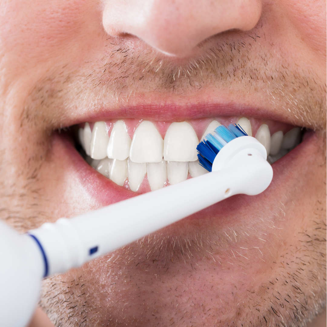 What are the Benefits of Using an Electric Toothbrush?