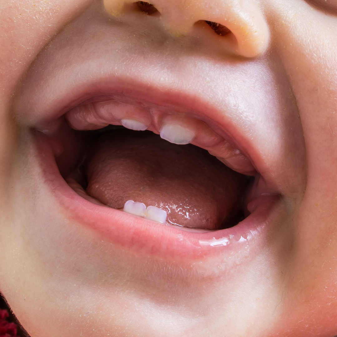 common-questions-about-baby-teeth-answered-ellicott-mills-dental